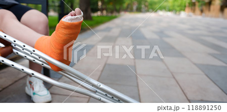 Prominently featured orange-casted leg in the foreground, with the tranquil scenery of a summer park providing the out-of-focus background, copy space 118891250
