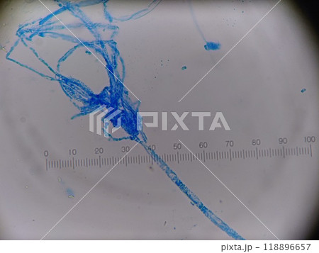 顕微鏡で見たカビの写真 顕微鏡で見たカビの写真 118896657