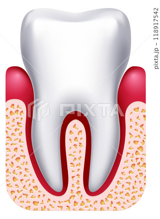 Gingivitis illustration. Gum disease. Dental treatment drawing 118917542