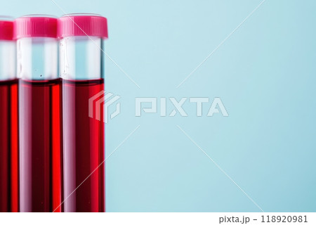 Laboratory test tubes filled with red liquid placed against a light blue background for clinical analysis 118920981