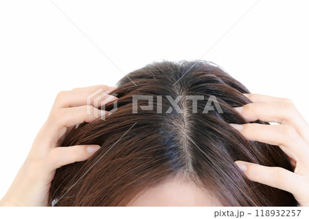 頭皮 ヘアケア 頭皮 ヘアケア 118932257
