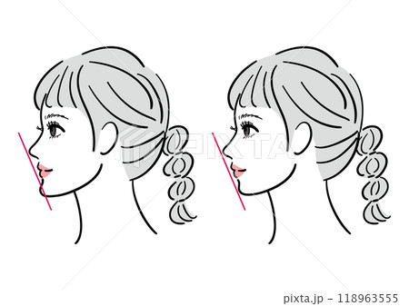 あごが出ている女性のビフォーアフター あごが出ている女性のビフォーアフター 118963555