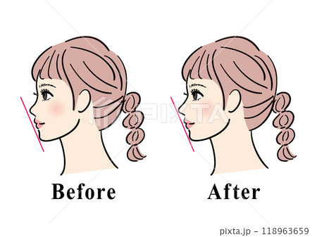鼻が低い女性の横顔のビフォーアフター 118963659