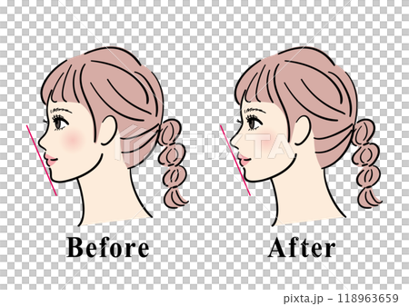 鼻が低い女性の横顔のビフォーアフター 118963659