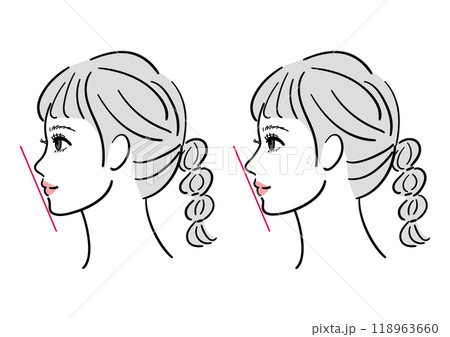 鼻が低い女性の横顔のビフォーアフター 118963660