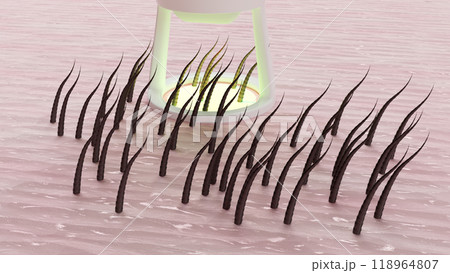 3d showing laser hair removal. advertisement for beauty salon. 3d illustration render 3d showing laser hair removal. advertisement for beauty salon. 3d illustration render 118964807