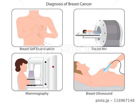 Diagnosis of Breast Cancer 118967148