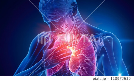 Lungs and Trachea - An anatomical illustration of a person experiencing chest pain 118973639