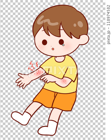 A boy with an itchy rash on his arm A boy with an itchy rash on his arm 118974582