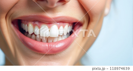 Closeup woman smile with pearly white teeth and healthy pink gums. dental care advertisements. Ideal for promoting oral hygiene products and dental services. Attractive and confident female smile Closeup woman smile with pearly white teeth and healthy pink gums. dental care advertisements. Ideal for promoting oral hygiene products and dental services. Attractive and confident female smile 118974639