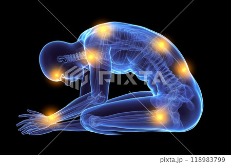 3d render of a male medical figure feeling joint pain 3d render of a male medical figure feeling joint pain 118983799
