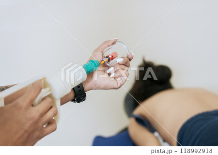 Close up of professional performing cupping treatment on patient, Modern Physiotherapy with cupping cups, Physiotherapist placing cupping on lying patient Close up of professional performing cupping treatment on patient, Modern Physiotherapy with cupping cups, Physiotherapist placing cupping on lying patient 118992918