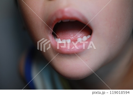 乳歯 デンタルケア 歯の健康 119018594