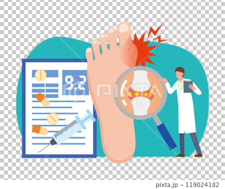 尿酸値と痛風発作 119024182