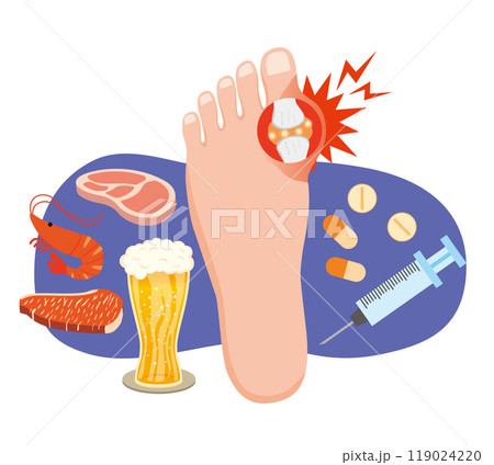 痛風発作のイメージイラスト 119024220