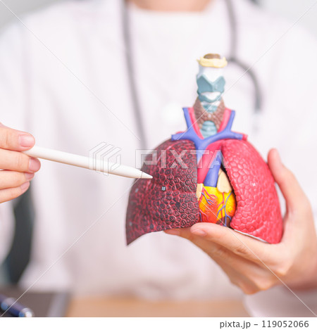 Doctor point Smoker Lung anatomy for Disease. Lung Cancer, Asthma, Chronic Obstructive Pulmonary or COPD, Bronchitis, Emphysema, Cystic Fibrosis, Bronchiectasis, Pneumonia and September world Lung day 119052066