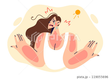 Unfortunate woman received sunburns on face and body due to being under blazing sun for long time 119055696