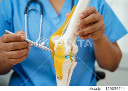 Knee osteoarthritis, Doctor showing model knee joint orthopedic. Knee osteoarthritis, Doctor showing model knee joint orthopedic. 119059644