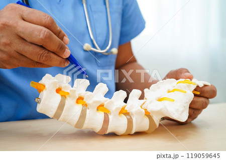 Asian doctor holding spinal nerve and bone model, Lumbar spine displaced herniated disc fragment for treatment medical in the orthopedic department. 119059645