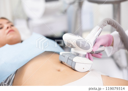LPG massage device applied on young woman's belly 119079314