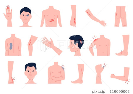 Physical injury. Human body parts with various wounds injury bruise. Physical traumas on head hand legs or face, bones fractures and cut, recent vector set 119090002