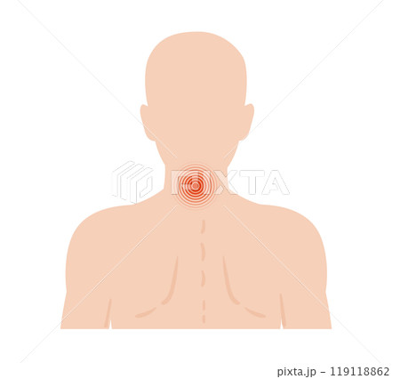 Human body highlighting pain spots, with a focus on the central neck area, indicating potential discomfort or stress areas relevant to human health 119118862