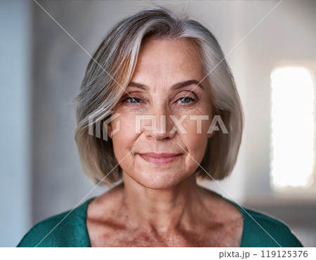 Woman Suffering From Sun Damage Actinic Keratosis 119125376