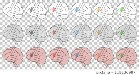 布羅卡場圖 119136997