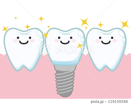 インプラント(キャラクター) インプラント(キャラクター) 119150588