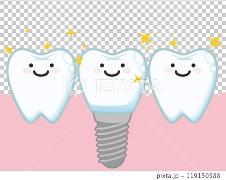 Implant (character) 119150588