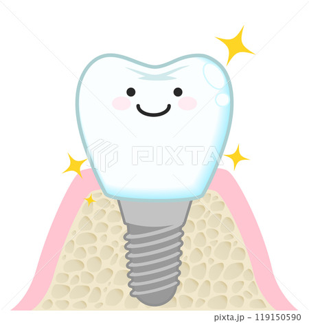 インプラント(キャラクター) インプラント(キャラクター) 119150590