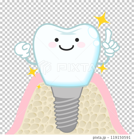 インプラント（キャラクター） 119150591