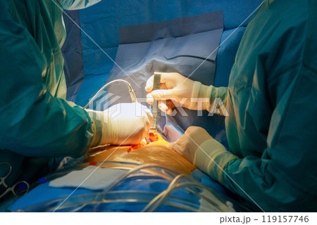 Open heart surgery is performed in an operating room at hospital by medical team of surgeons Open heart surgery is performed in an operating room at hospital by medical team of surgeons 119157746