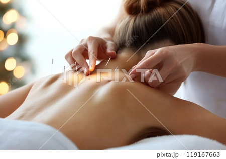 Holistic wellness: ancient practice of acupuncture, delicate placement of needles on the human body, emphasizing balance, healing, and the therapeutic benefits of this traditional method. 119167663