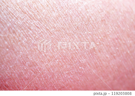 dry and dehydrated human skin texture background 119203808