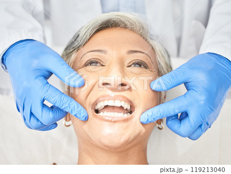 Senior woman, mouth and dentist hands with dental procedure, medical and healthcare with closeup. Oral health, orthodontics and patient with doctor, teeth whitening and veneers with assessment 119213040