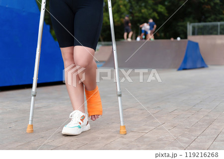 plastered female leg in an orange bandage in the background of a summer skate park, crutches for balance and mobility aid 119216268