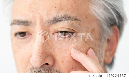 メンズビューティー　しみ　アップ　目元 119229387