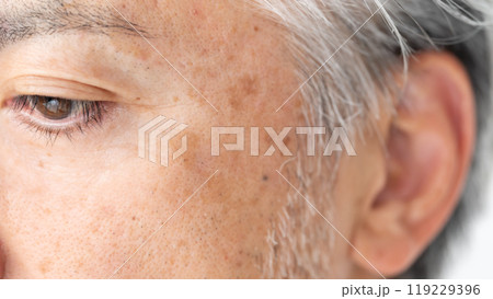 メンズビューティー　しみ　アップ　目元 119229396