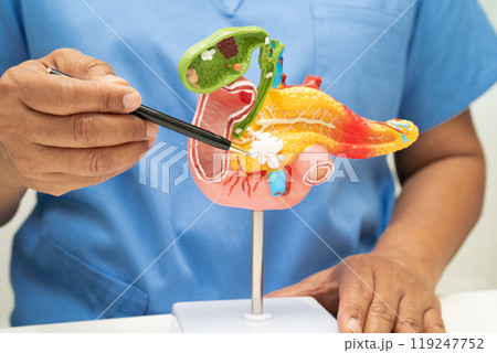 Pancreatitis, pancreatic cancer, Asian doctor with pancreas, gallbladder and bile duct human anatomy model at hospital. 119247752
