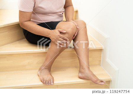Asian lady fall down the stairs and pain at knee because slippery surfaces. 119247754