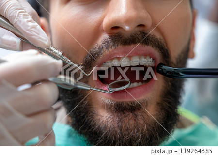 Patient in dental chair receiving oral examination or professional treatment from skilled dentist 119264385