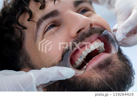 Bearded man patient during treatment procedure with dental tools in dentist office 119264429