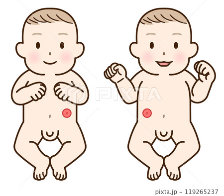 人工肛門、ストーマ、大腸、子供、こども、赤ちゃん、イラスト、illustration 119265237