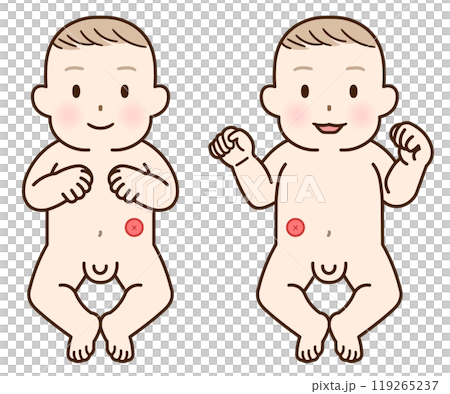 人工肛門、ストーマ、大腸、子供、こども、赤ちゃん、イラスト、illustration 119265237