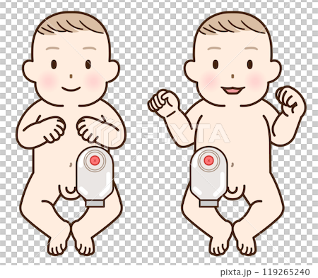 人工肛門、ストーマ、大腸、子供、こども、赤ちゃん、イラスト、illustration 119265240