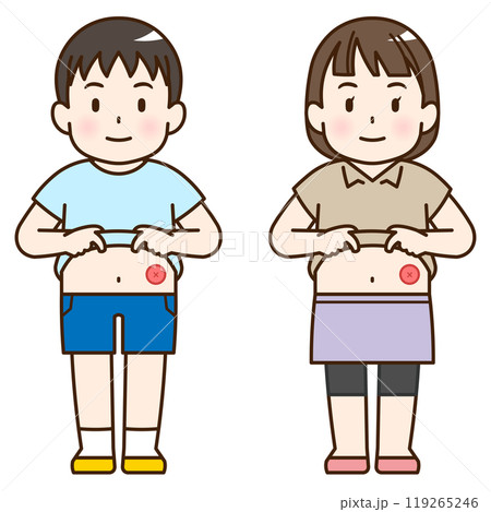 人工肛門、ストーマ、大腸、子供、こども、赤ちゃん、イラスト、illustration 人工肛門、ストーマ、大腸、子供、こども、赤ちゃん、イラスト、illustration 119265246