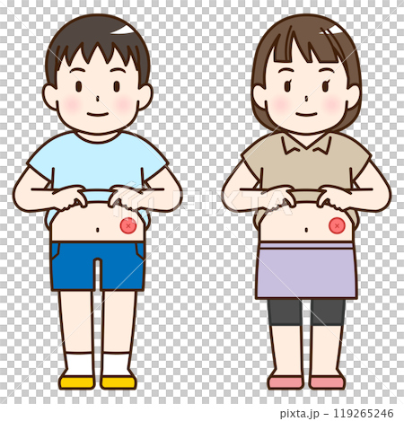 人工肛門、ストーマ、大腸、子供、こども、赤ちゃん、イラスト、illustration 人工肛門、ストーマ、大腸、子供、こども、赤ちゃん、イラスト、illustration 119265246