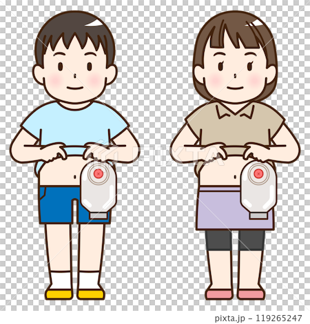 人工肛門、ストーマ、大腸、子供、こども、赤ちゃん、イラスト、illustration 人工肛門、ストーマ、大腸、子供、こども、赤ちゃん、イラスト、illustration 119265247