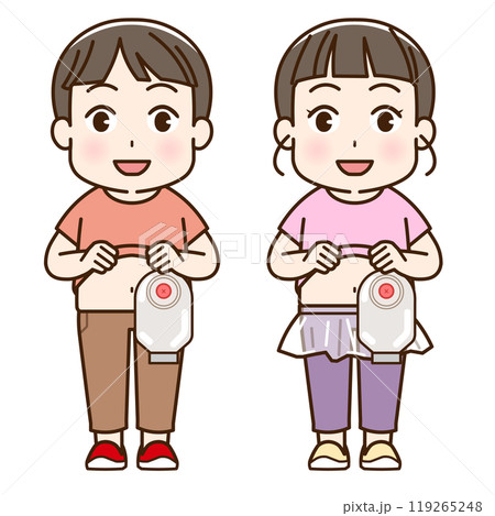 人工肛門、ストーマ、大腸、子供、こども、赤ちゃん、イラスト、illustration 119265248